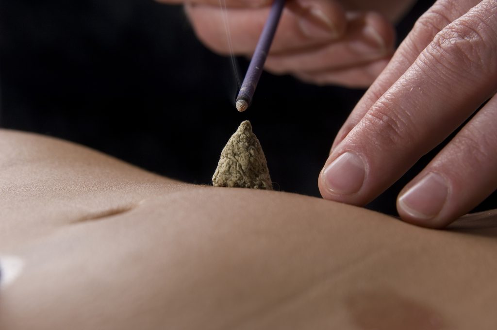 moxibustion in Marbella